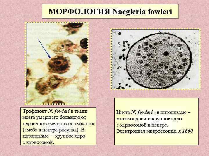МОРФОЛОГИЯ Naegleria fowleri Трофозоит N. fowleri в ткани мозга умершего больного от первичного менингоэнцефалита