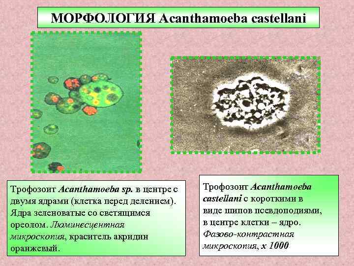 МОРФОЛОГИЯ Acanthamoeba castellani Трофозоит Acanthamoeba sp. в центре с двумя ядрами (клетка перед делением).