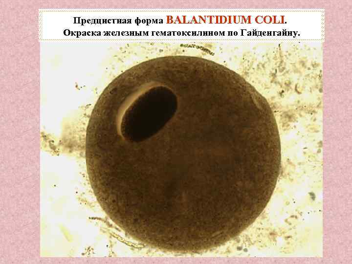 Предцистная форма BALANTIDIUM COLI. Окраска железным гематоксилином по Гайденгайну. 