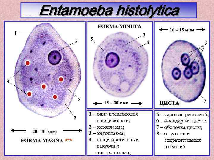Entamoeba histolytica FORMA MINUTA 1 3 5 5 10 – 15 мкм 2 6