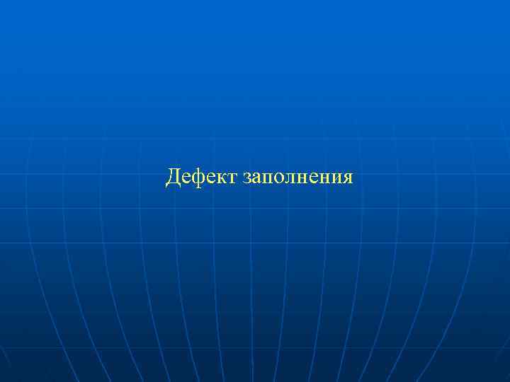 Дефект заполнения 