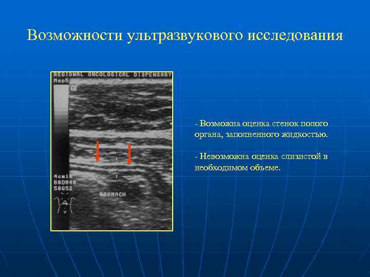 Возможности ультразвукового исследования - Возможна оценка стенок полого органа, заполненного жидкостью. - Невозможна оценка
