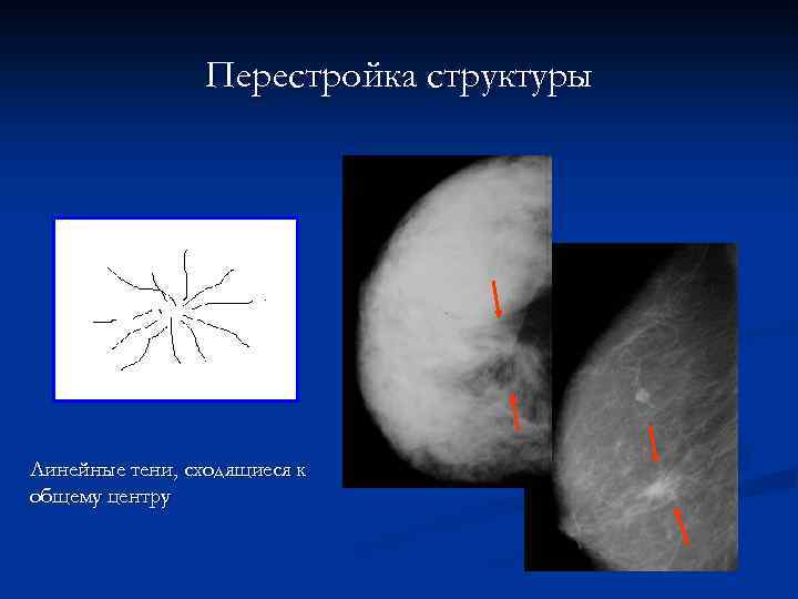 Перестройка структуры Линейные тени, сходящиеся к общему центру 