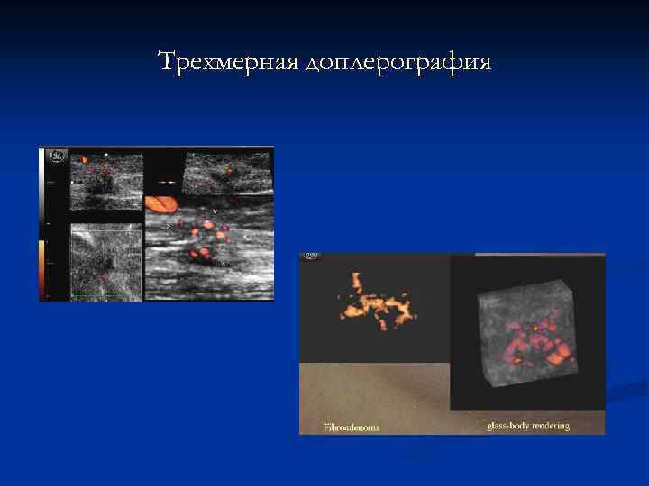 Лучевая диагностика заболеваний молочных желез презентация