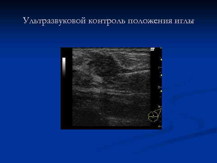 Лучевая диагностика заболеваний молочных желез презентация