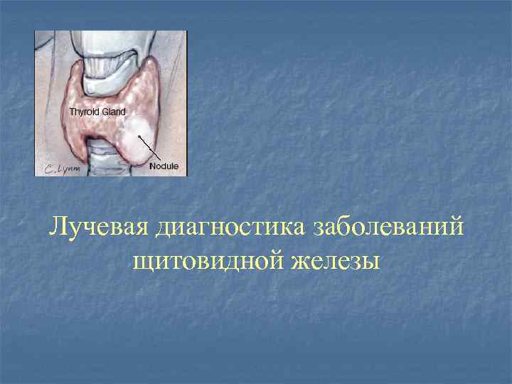 Лучевая диагностика заболеваний щитовидной железы 
