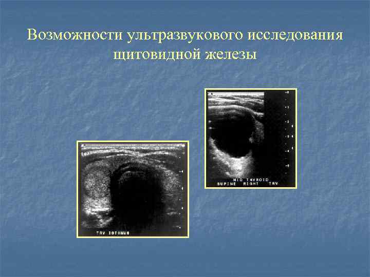 Лучевая диагностика в эндокринологии презентация