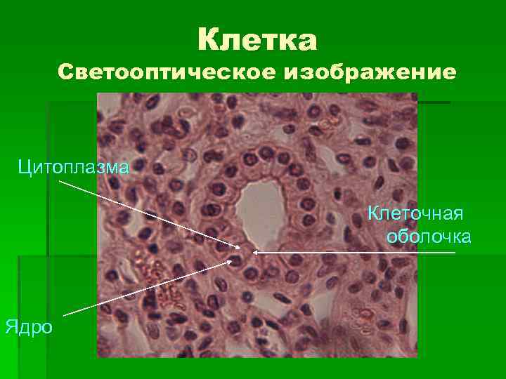 Клетка Светооптическое изображение Цитоплазма Клеточная оболочка Ядро 