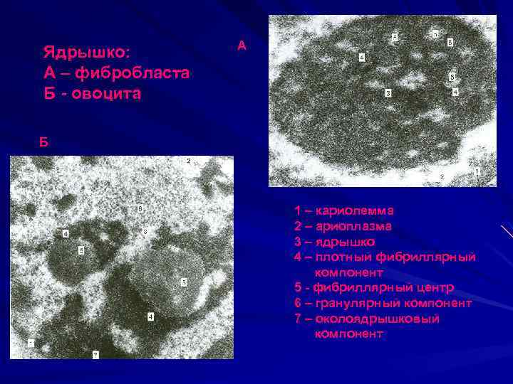 Ядрышко: А – фибробласта Б - овоцита А Б 1 – кариолемма 2 –