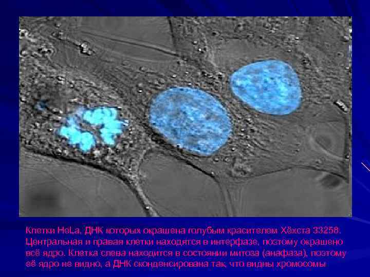 Клетки He. La, ДНК которых окрашена голубым красителем Хёхста 33258. Центральная и правая клетки