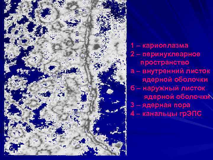 1 – кариоплазма 2 – перинуклеарное пространство а – внутренний листок ядерной оболочки б