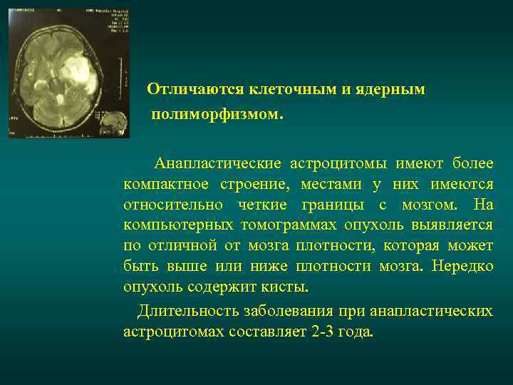 Отличаются клеточным и ядерным полиморфизмом. Анапластические астроцитомы имеют более компактное строение, местами у них