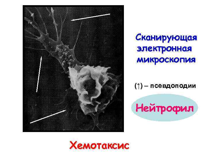 Сканирующая электронная микроскопия (↑) – псевдоподии Нейтрофил Хемотаксис 