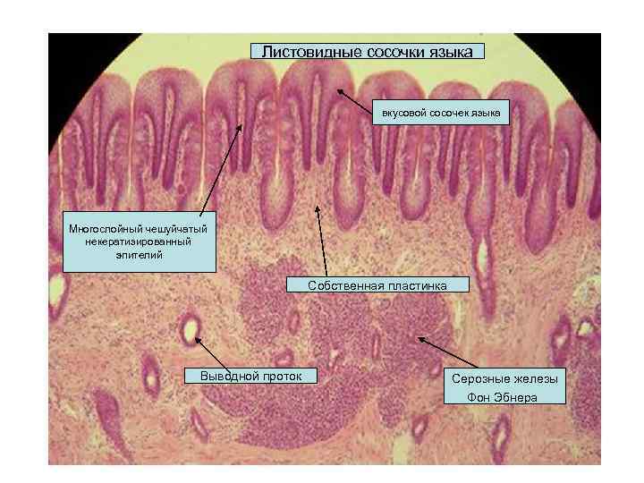 Листовидные сосочки языка вкусовой сосочек языка Многослойный чешуйчатый некератизированный эпителий Собственная пластинка Выводной проток