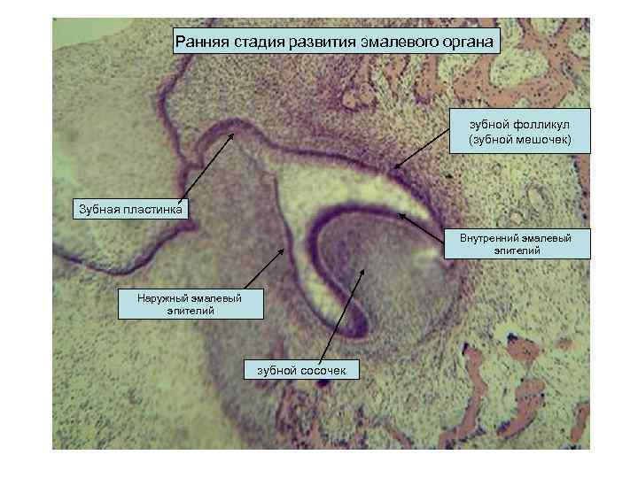 Ранняя стадия развития эмалевого органа зубной фолликул (зубной мешочек) Зубная пластинка Внутренний эмалевый эпителий