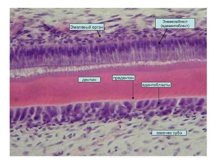 Энамелобласт (адамантобласт) Эмалевый орган дентин предентин одонтобласты сосочек зуба 