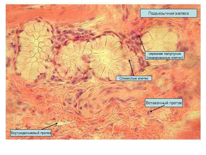 Подъязычная железа серозное полулуние (серомукозные клетки) Слизистые клетки Вставочный проток Внутридольковый проток 