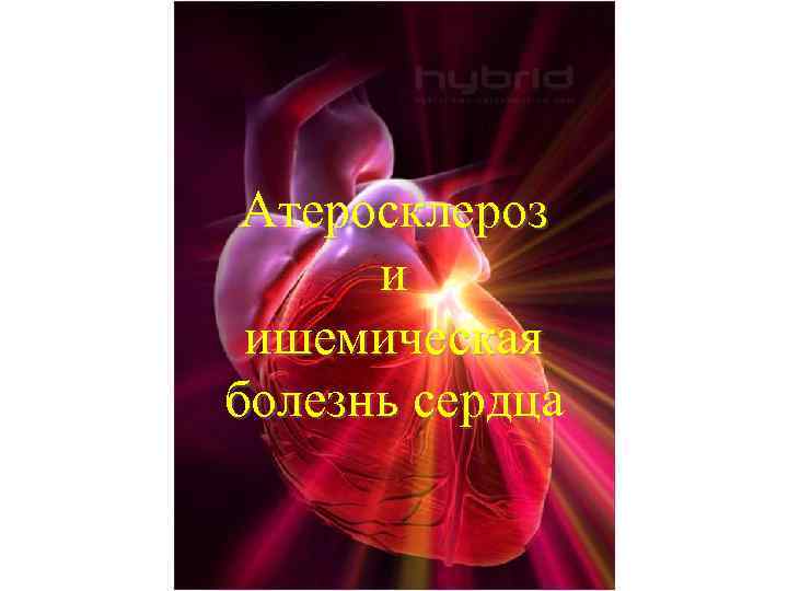 Атеросклероз и ишемическая болезнь сердца 