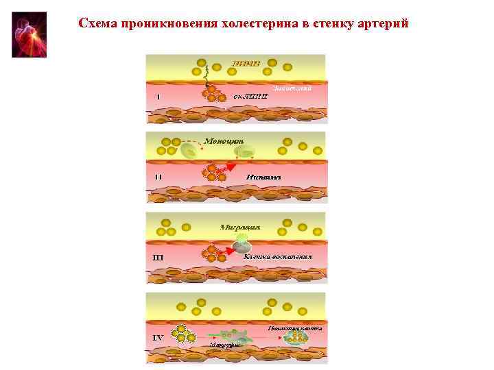 Схема проникновения холестерина в стенку артерий 