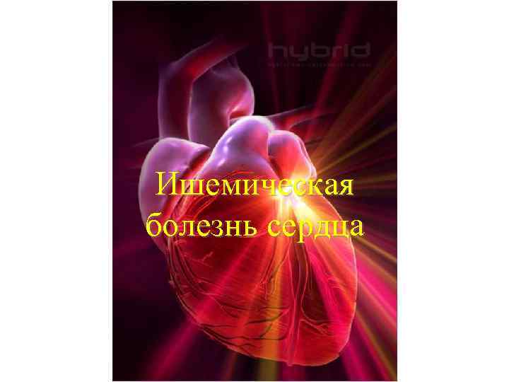 Ишемическая болезнь сердца 