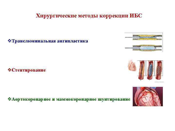 Хирургические методы коррекции ИБС v. Транслюминальная ангипластика v. Стентирование v. Аортокоронарное и маммокоронарное шунтирование