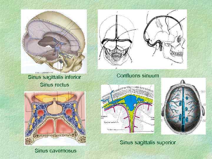 Sinus sagittalis inferior Sinus rectus Сonfluens sinuum Sinus sagittalis superior Sinus cavernosus 