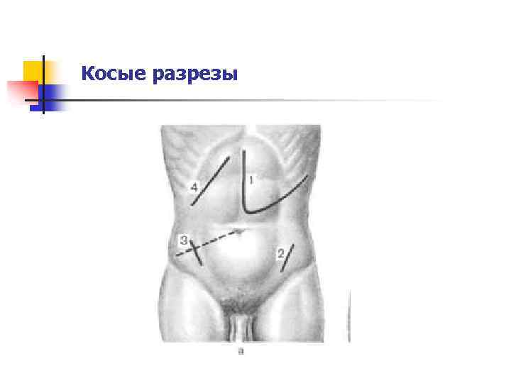 Косые разрезы 