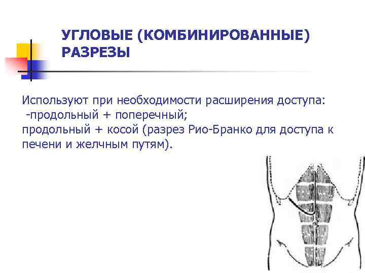 УГЛОВЫЕ (КОМБИНИРОВАННЫЕ) РАЗРЕЗЫ Используют при необходимости расширения доступа: -продольный + поперечный; продольный + косой