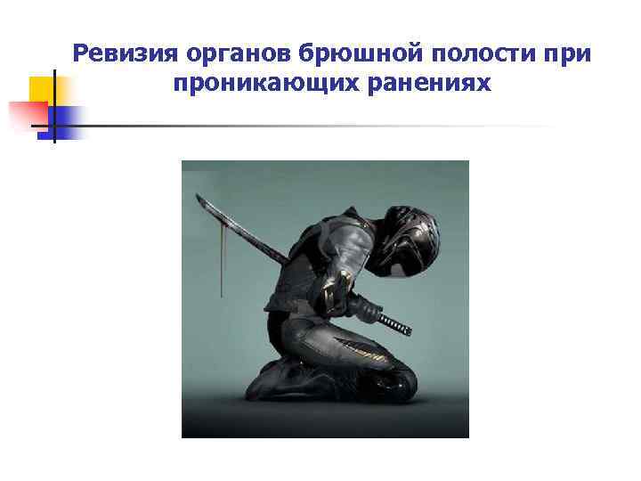 Ревизия органов брюшной полости проникающих ранениях 