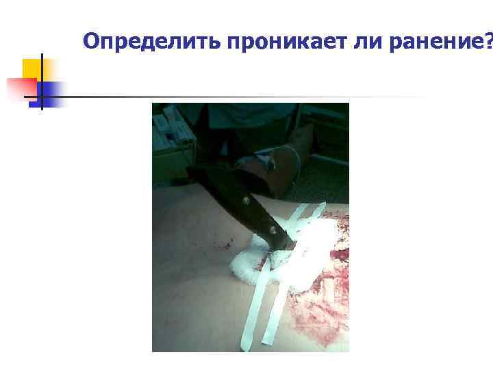 Определить проникает ли ранение? 