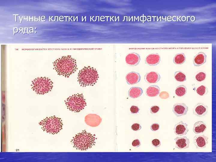 Тучные клетки и клетки лимфатического ряда: 