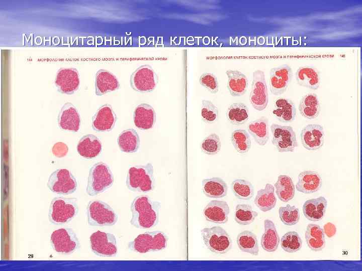 Ряд клеток. Морфология клеток моноцитарного ряда. Моноцитарный ряд. Клетки моноцитарного ряда гемопоэза. Моноцитарный Росток кроветворения.