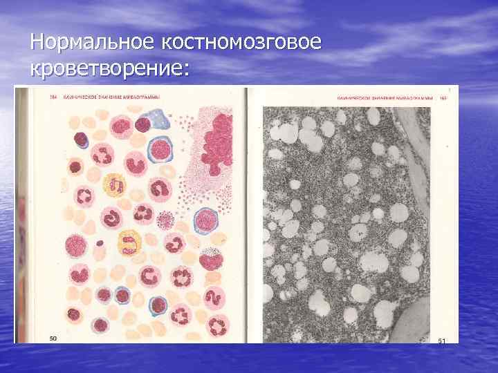 Нормальное костномозговое кроветворение: 