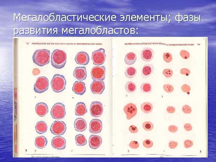 Тест элемента крови. Мегалобластный Тип кроветворения. Мегалобласты и мегалоциты. Мегалобластный эритропоэз.