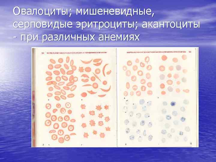 Посмотрите на изображение эритроцитов в разной среде в каком