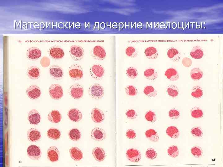 Материнские и дочерние миелоциты: 