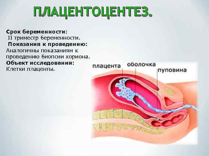 ПЛАЦЕНТОЦЕНТЕЗ. Срок беременности: II триместр беременности. Показания к проведению: Аналогичны показаниям к проведению биопсии
