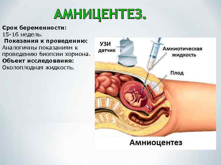 АМНИЦЕНТЕЗ. Срок беременности: 15 -16 недель. Показания к проведению: Аналогичны показаниям к проведению биопсии