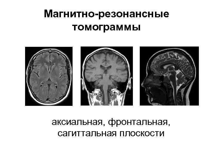 Магнитно-резонансные томограммы аксиальная, фронтальная, сагиттальная плоскости 