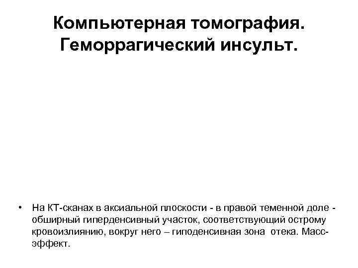 Компьютерная томография. Геморрагический инсульт. • На КТ-сканах в аксиальной плоскости - в правой теменной