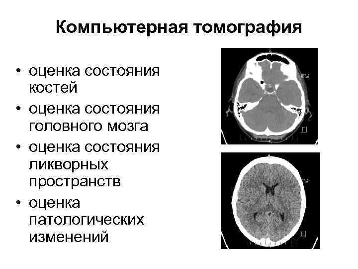 Компьютерная томография • оценка состояния костей • оценка состояния головного мозга • оценка состояния