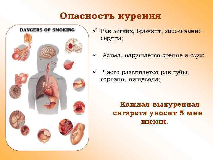 Опасность курения ü Рак легких, бронхит, заболевание сердца; ü Астма, нарушается зрение и слух;