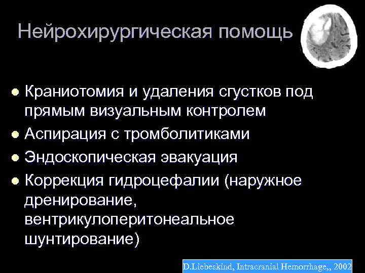 Нейрохирургическая помощь Краниотомия и удаления сгустков под прямым визуальным контролем l Аспирация с тромболитиками