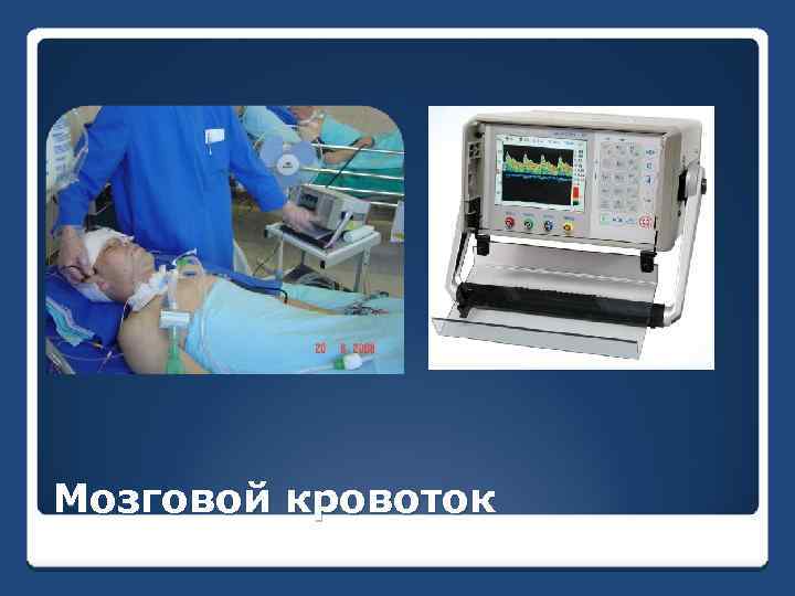 Мозговой кровоток 