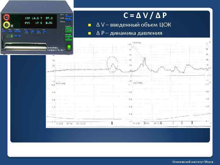 C=ΔV/ΔP n n Δ V – введенный объем ЦСЖ Δ P – динамика давления