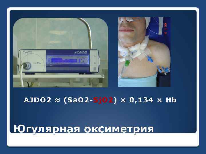 AJDO 2 ≈ (Sa. O 2 - Sj. O 2 ) × 0, 134