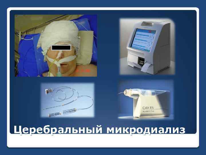 Церебральный микродиализ 