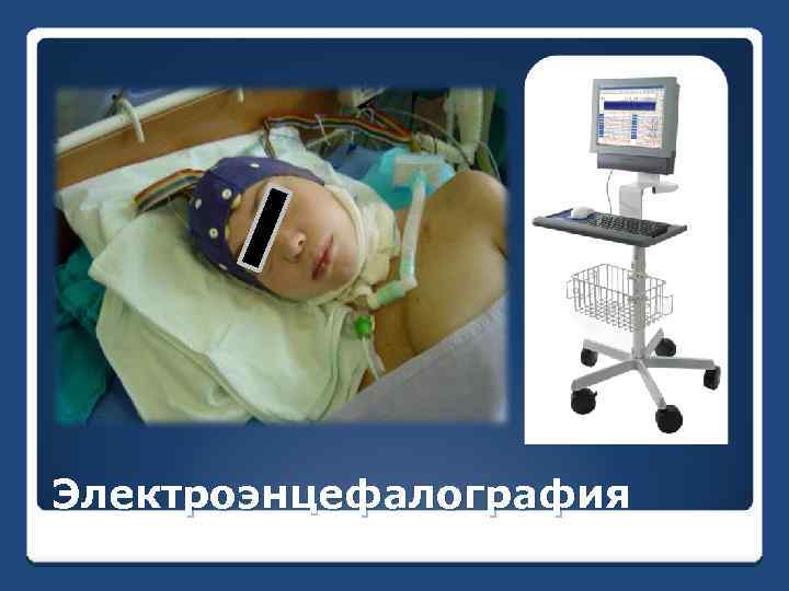 Электроэнцефалография 