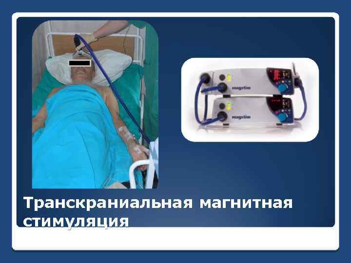 Транскраниальная магнитная стимуляция 