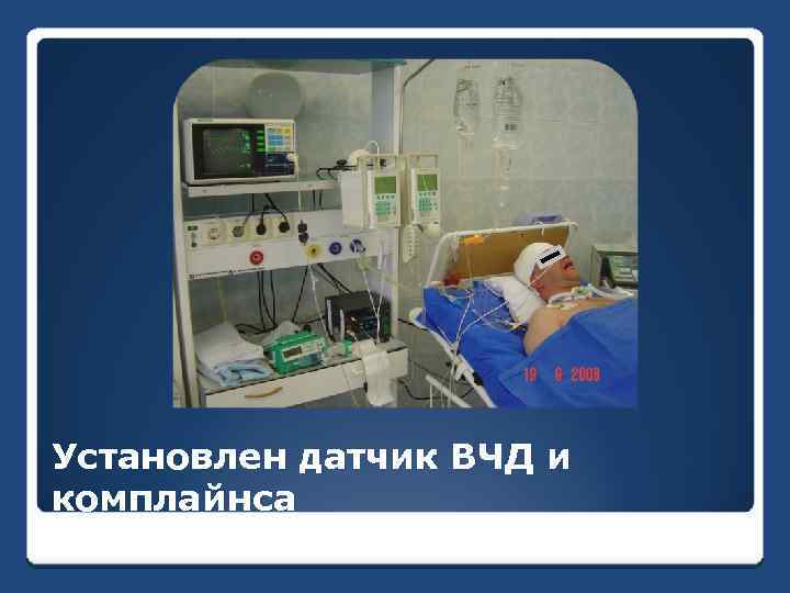 Установлен датчик ВЧД и комплайнса 